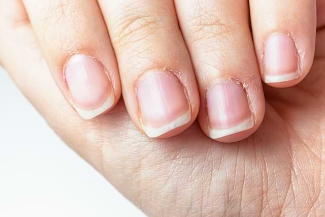 Trockene Nagelhaut: So pflegst du sie weich